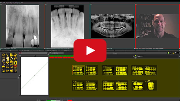 cadi training video